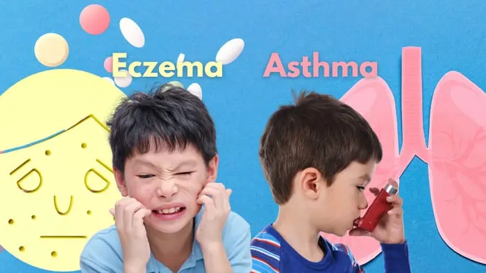 How Nannies can Support Children with Eczema or Asthma